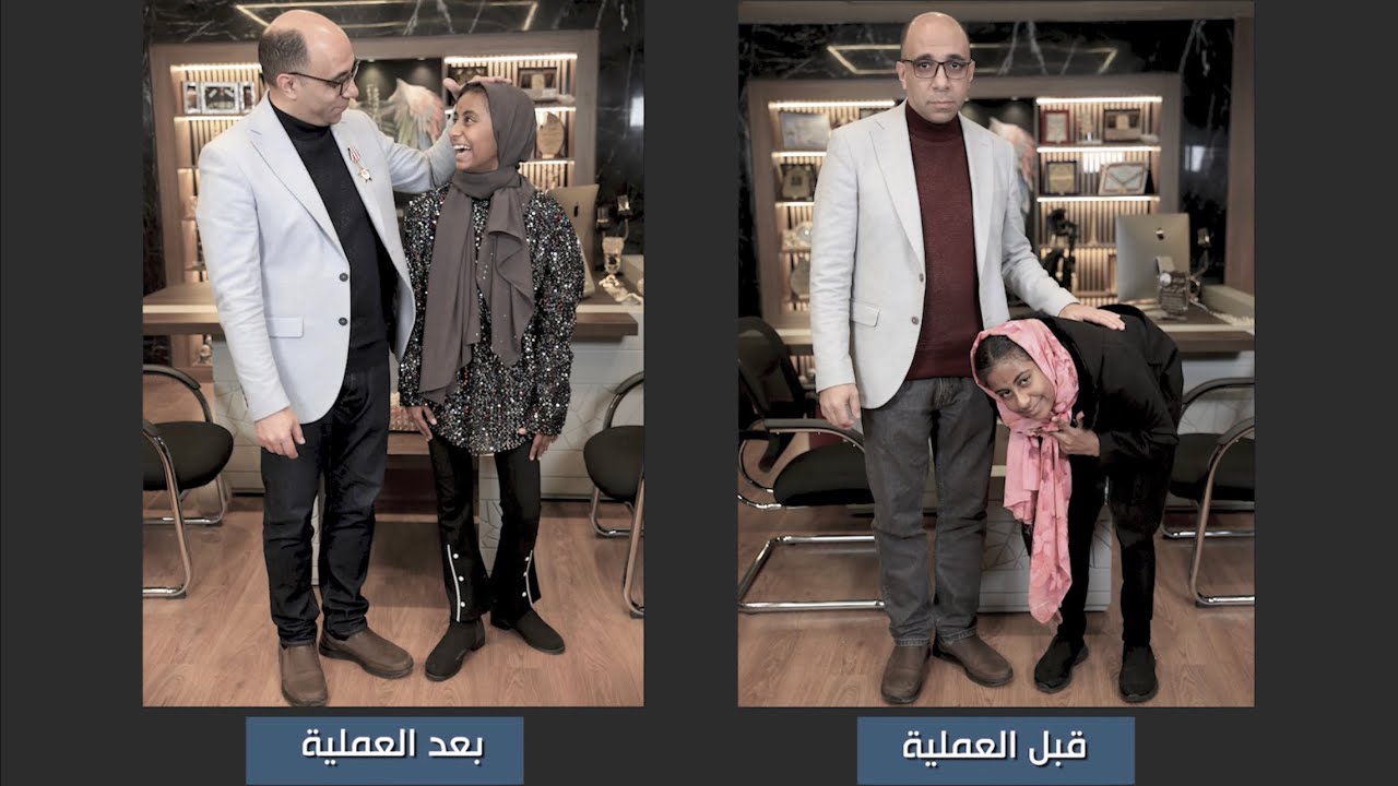 محدش يعيط😥😥 إيناس اصبحت واحدة تانيه خالص بعد جراحة تصليح تحدب نادر بالعمود الفقري