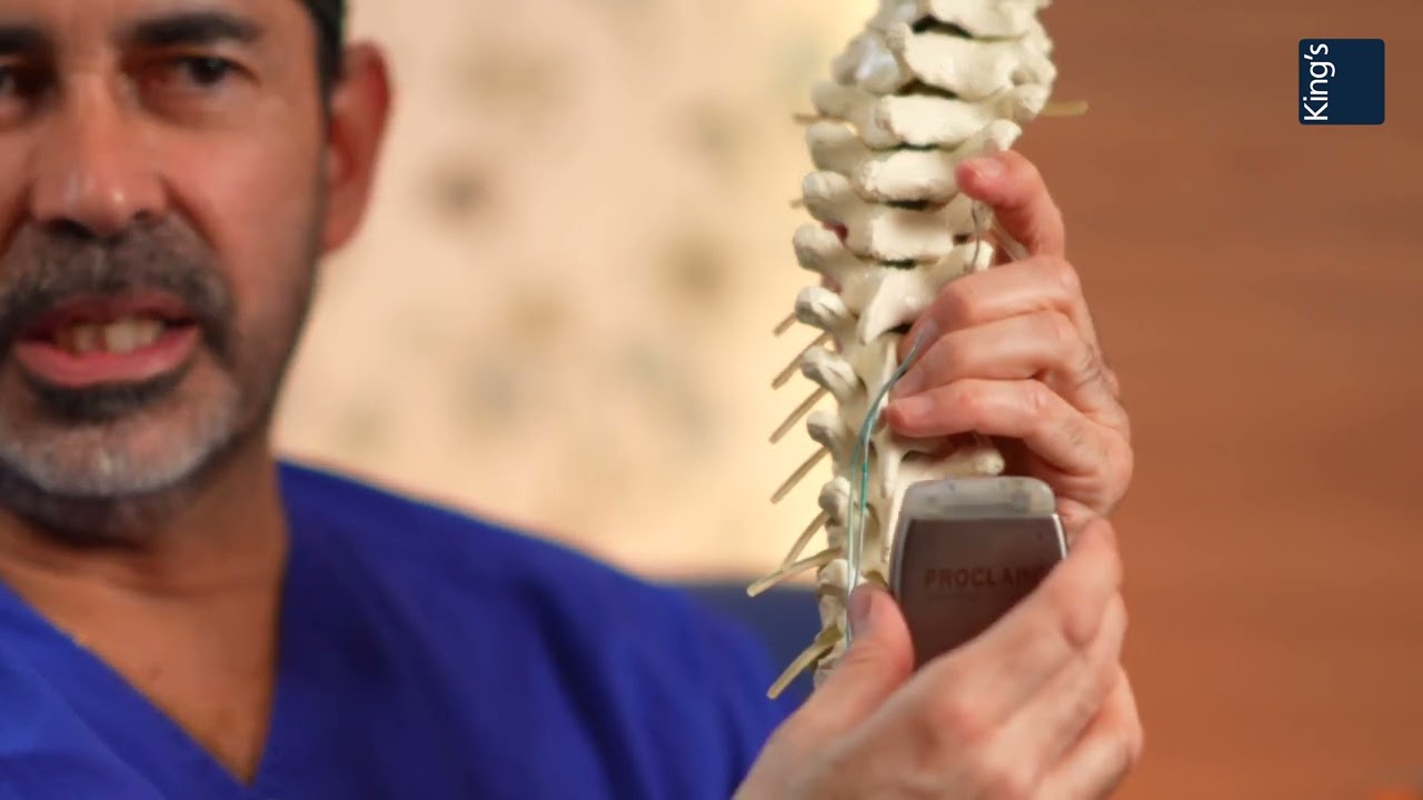 Spinal Cord Stimulator Surgery: A Life-Changing Solution for Chronic Pain | Patient Testimonial