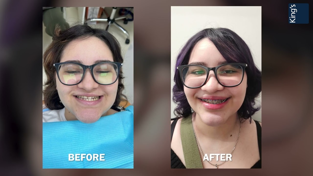 Oral and Maxillofacial Surgery | Dr Kartic Rajaram | King