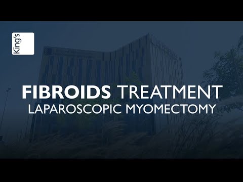 𝐅𝐢𝐛𝐫𝐨𝐢𝐝𝐬 𝐓𝐫𝐞𝐚𝐭𝐦𝐞𝐧𝐭 𝐢𝐧 𝐃𝐮𝐛𝐚𝐢 - 𝐋𝐚𝐩𝐚𝐫𝐨𝐬𝐜𝐨𝐩𝐢𝐜 𝐌𝐲𝐨𝐦𝐞𝐜𝐭𝐨𝐦𝐲 | 𝐏𝐚𝐭𝐢𝐞𝐧𝐭 𝐓𝐞𝐬𝐭𝐢𝐦𝐨𝐧𝐢𝐚𝐥 | 𝐃𝐫 𝐇𝐞𝐧𝐚 𝐊𝐚𝐥𝐚𝐦
