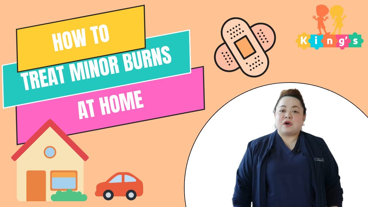 How to Treat Minor Burns at Home | King