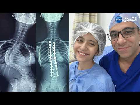 تقرير التلفزيون الجزائري عن جراحات تشوه العمود الفقري اجراها د. هاني عبدالجواد ل مرضي من كل البلدان